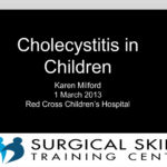 cholecyctitis-dr-karen-milford