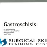 gastroschisis-dr-a-knowles