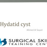 hydatid-disease-dr-al-sayari