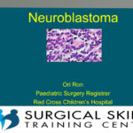 neuroblastoma-webmeeting-dr-ori-ron