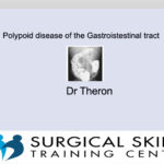 polypoid-disease-of-the-gastroistestinal tract-webmeeting-dr-theron