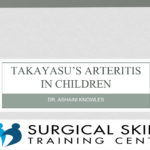 takayasu-arteritis-dr-a-knowles